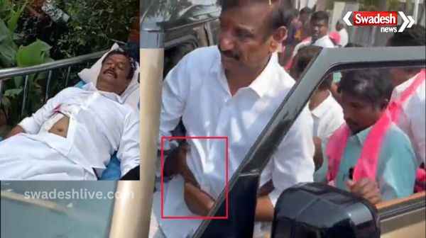 Hyderabad: Medak MP Kotha Prabhakar Reddy attacked with knife